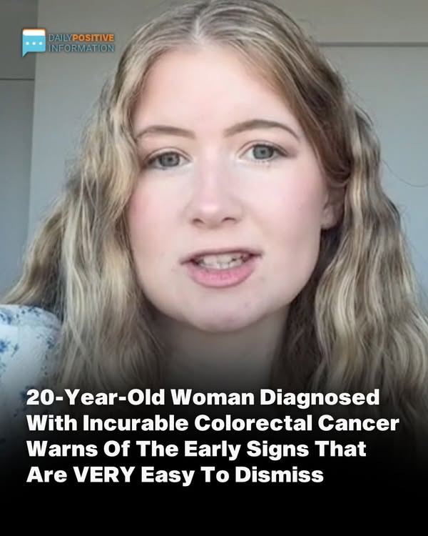 20-Year-Old Woman With Terminal Colon Cancer Warns Of The Early Symptoms That Are Simple To Ignore