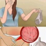 A woman’s underwear smells bad when… see more