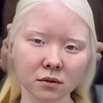 From Snow-White to Brunette: Albino Girl’s Jaw-Dropping Transformation!