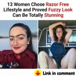 13 Women Chose Razor Free Lifestyle and Proved Fuzzy Look Can Be Totally Stunning