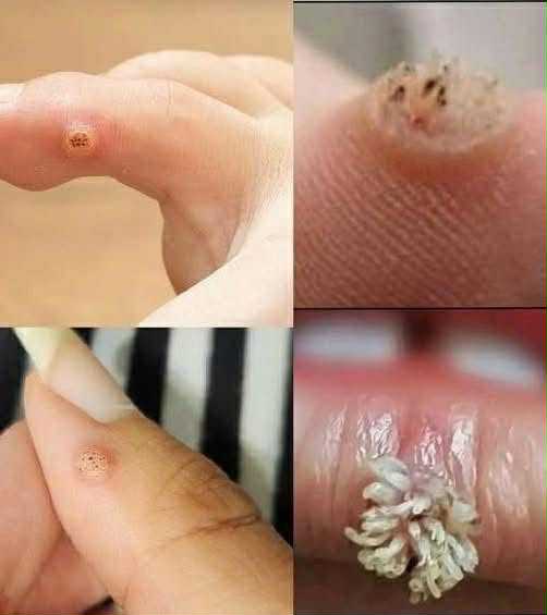 BE VERY CAREFUL. If you get this, you are infected with….