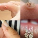 BE VERY CAREFUL 🚨. If you get this, you are infected with …. See more in comment 👇 ♥️✅🌎