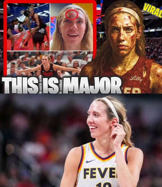 More Than a Knot: Lexie Hull’s Gruesome Injury and Unbreakable Spirit Ignite Indiana Fever’s Playoff Dream in Legendary Win