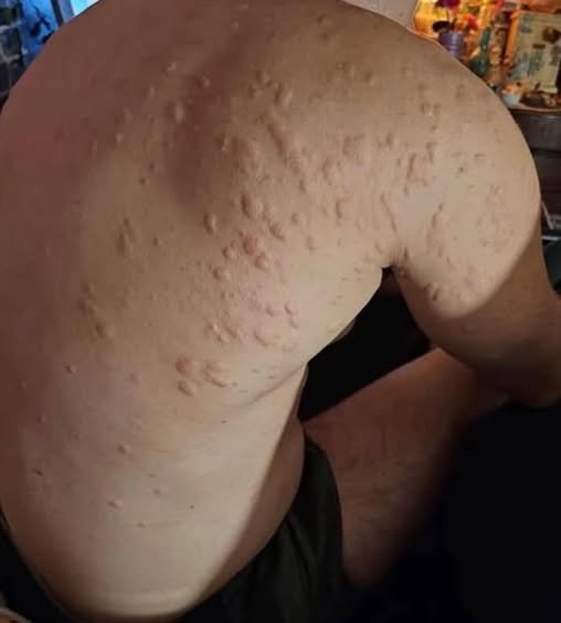 These are the consequences of sleeping with the…See more