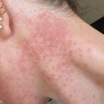 These are the consequences of eating…