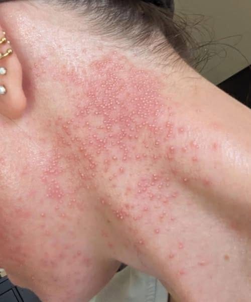 These are the consequences of eating…