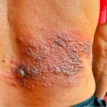 What Happens When You Sleep Like This