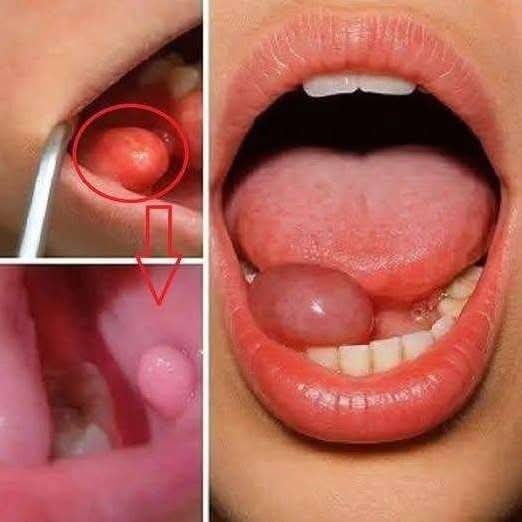 These Are The First Symptoms Of A…