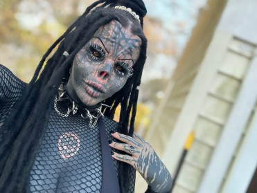 Toxii’s transformation: Before & after photos