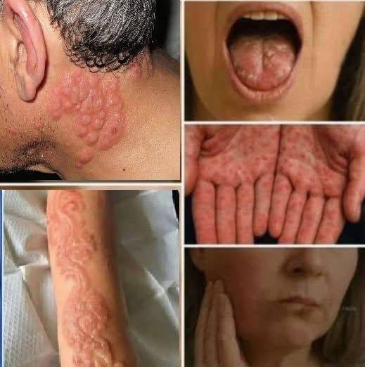 These are the signs that he is cr… See more