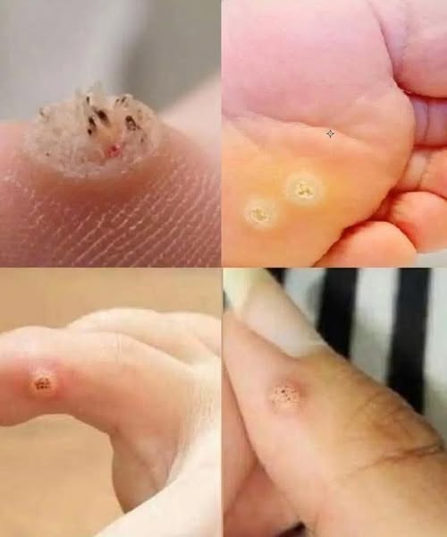 BE VERY CAREFUL . If you get this, you are infected with …. See more