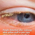People disturbed after realising what yellow stuff in your eyes when you wake up actually is