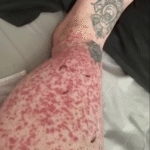 These are the consequences