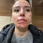 Be careful! These are the consequences of sleeping with the…