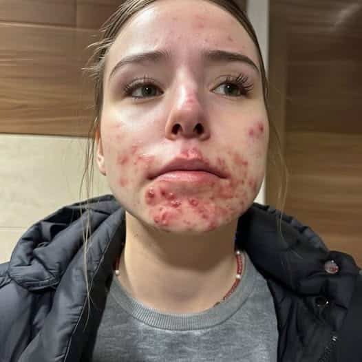 Be careful! These are the consequences of sleeping with the…