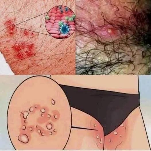 These are the signs that he is cr… See more