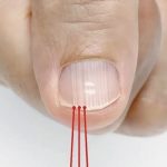 If you have these lines on your nails after 40, it is a clear sign that