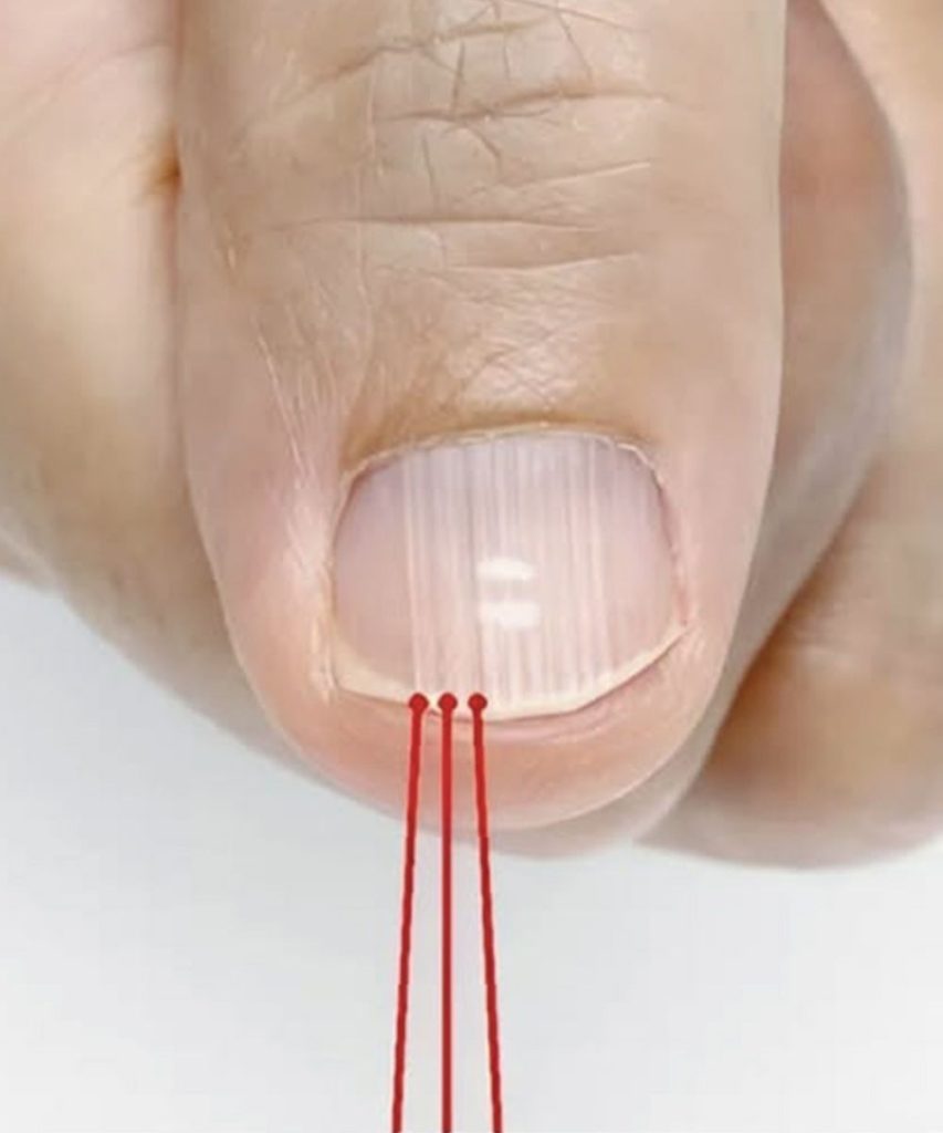 If you have these lines on your nails after 40, it is a clear sign that