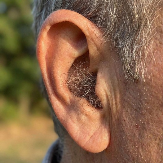 Why Ear Hair Grows Naturally With Age